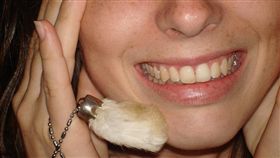 -牙齒-▲圖／攝影者Travis Rigel Lukas Hornung, flickr CC License-https://www.flickr.com/photos/awfulshot/1085106369/