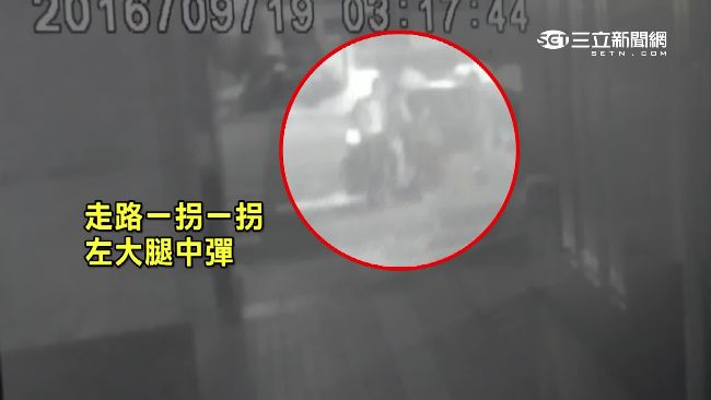車上玩槍走火轟腿　謊稱遭仇家報復