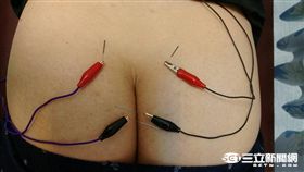 尿失禁！一咳嗽褲子就濕　她不敢出門