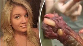 紅燒肋排驚見狗腿 圖／翻攝自《每日星報》http://www.dailystar.co.uk/news/latest-news/546968/china-palace-dog-paw-rib-ashley-jefferson-spare-ribs