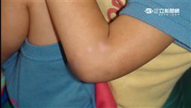 -虐童-家暴-（示意圖）