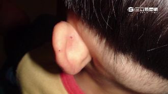 女毒梟擄男童當掩護　不乖就菸燙毒打