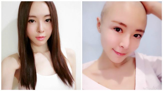 女星罹卵巢癌　公開光頭照堅強面對
