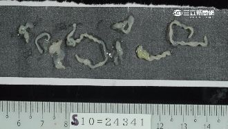 喝生水吃生魚片　絛蟲寄生脊髓險癱瘓