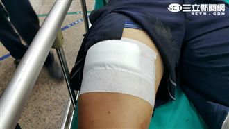 勸阻KTV鬥毆　員警遭割傷血流不止