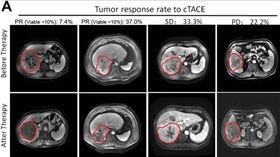 癌細胞 圖/翻攝自elifesciences.org 16:9