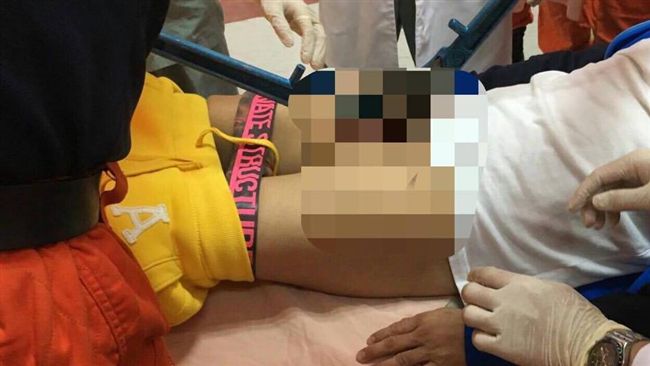 男子慘遭陰莖環卡鳥　警消到場超傻眼