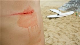 傷痕
https://www.flickr.com/photos/eelkedekker/2776373878/in/photolist-ssZR6-8dfWTP-8Nupwz-5ekDe9-JXHxX-4yTUcG-bd1J8-dkUYnu-gAneg-JN3MV-6qbqMb-7v3Fht-pd3WY6-pRFeKy-9JHx8v-4dcZ-5jdn-s6eqhq-ss1NP-5sL2SC-e3g38-e7pGpG-9VoNFm-qcw9Db-anxQB8-7PyFCc-78XeET-2WRiAV-vQ1Cr-djUKgX-7b9Krq-3gRo2Y-7zpgU1-e13o4C-dVtaC-rsQfg-4i6Frw-a5RdtC-51tQkv-p9sqP1-cvkFqG-Pp294-cvkDvS-dBRgS-82CaZ3-goTmeg-o1pb18-dSzHrM-6EnVTE-h3nZ7D