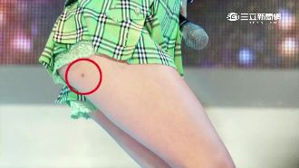 韓女星大腿都有黑點　原來是減肥手法