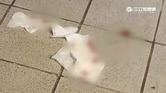 嫌太吵砸玻璃瓶？女學生頭濺血送醫