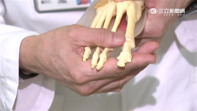 老翁被門夾到破皮　幾天後腳趾險截肢