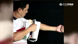火燒皮膚不會受傷？　專家一秒破解