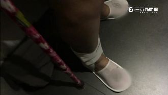 控旅館燈昏暗害跌倒　港客腳背骨裂