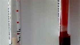 牛奶血　成都　大陸