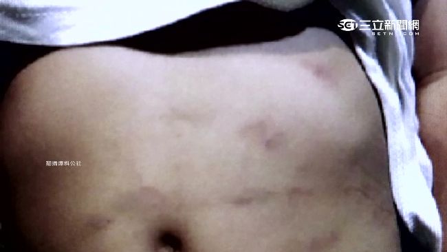 童疑遭虐致腦出血　繼父爆經常辱罵…