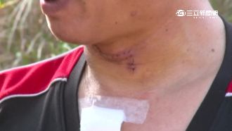 男鐮刀攻擊警　曾「割喉」運將獲輕判