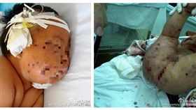 大陸杭州遭母親刺傷男嬰（圖／翻攝自京華時報微博）