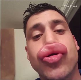 網友,免費,豐唇,黃蜂,金卡達夏 圖/翻攝自臉書