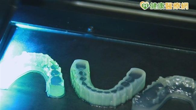 顎面骨異常　3D數位醫療解救她