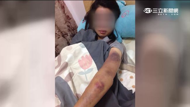 跨國戀被當小三　港女遭關摩鐵虐打