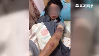 跨國戀被當小三　港女遭關摩鐵虐打