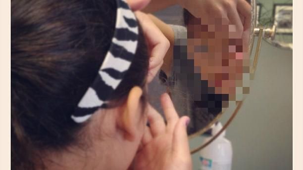 隱眼戴10小時才摘　正妹誤撕下角膜