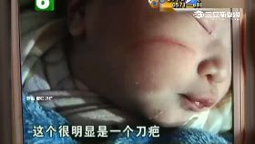 剖腹割破臉1200.