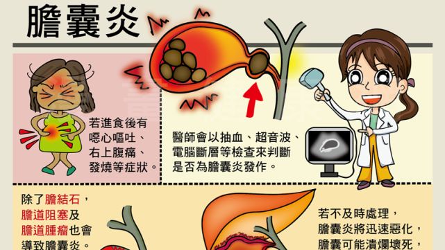 飯後常腹脹不舒服　當心是膽結石作祟