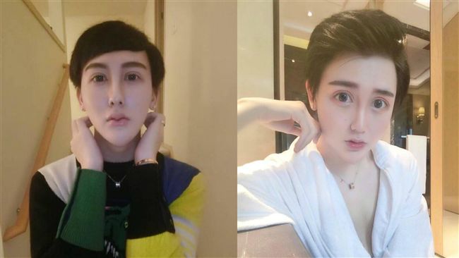 找醫生捏鼻鑑定　蛇精男PO影自清