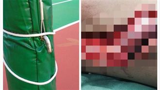 恐怖！網球場鐵鉤　竟割開男童大腿