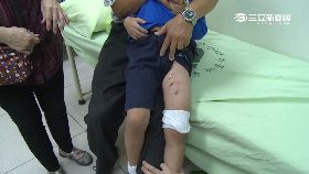 d野狗咬傷童1200