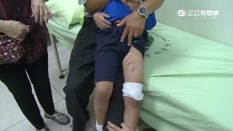 兩週爆三起！野狗出沒國小咬傷5歲童