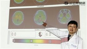 葉啟斌醫師說，有行為疾患的人，腦部血清素比一般正常人低。（圖／楊晴雯攝）