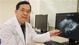 子宮,避孕器,穿孔,超音波
圖／中央社