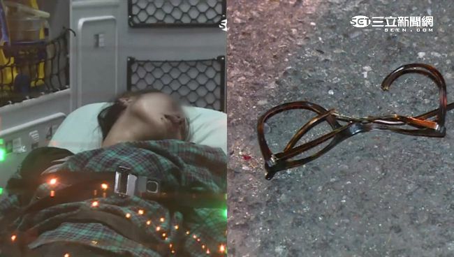 遭外籍男友痛毆　女大生還想嫁給他