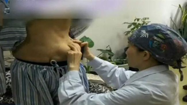 女子做隆乳手術　奶竟「掉到肚子上」