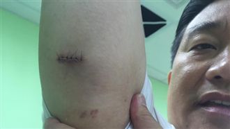 被告殺人未遂　王定宇將反告藍委傷害