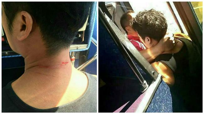 包車北上挺同　男遭反同司機利剪割脖