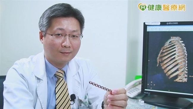 六旬男多處肋骨斷　量身訂製骨釘板