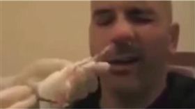 鼻子,手術,紗布,寄生蟲,護士,砂條,YouTube　圖／翻攝自Time Break YouTube頻道