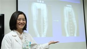 孩童O型腿  醫師籲注意佝僂症
奇美醫學中心兒科部兒童內分泌科主任王碩郁表示，孩
童持續下肢變形可能是佝僂症導致。缺乏鈣質及維生素
D的營養性佝僂症可以預防，家長應多注意。
中央社記者楊思瑞攝  105年12月15日