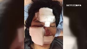 溝縫害慘摔g1800