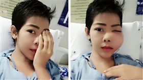正妹,泰國,霸凌,網路,癌症,變型,韓國,#世界最醜女人 圖／Jenie Yoo臉書　https://goo.gl/RHG1Tn