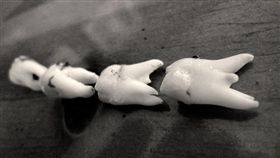 flickr牙齒／Chris Sorge／https://www.flickr.com/photos/stone65/6952862359/in/photolist-bApeKe-9XvJR-eSMuP3-3Bbkp-9UdzMd-4S9xsX-5HRrUr-Gw8Mj-5ESQe7-5jrhAS-jFZo-a4CKds-2xu5z-o64M-2qhx-65FGhT-bDVYmk-3GniyC-2UANnQ-64TD5-SKgzj-9miP7L-5Ej2Vh-aiwLzg-2ardLX-qxp8kP-5RKG3-7y6HUP-7pd42N-6DoUsS-7xHZAZ-85iTL6-8siiAf-4o3du-78wAcG-tsw45-2kXLWS-2kXLWJ-96mafo-azzKcQ-a5GKnW-e3q6w8-asosFS-6D9mM-dXTd-8s1Qoe-8vPBUN-4iE2Cz-8a6TxD-aLb3cV