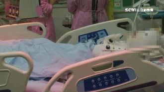 不滿被提分手　狠男火燒女友害毀容