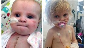 英國，女童，病童，換心（圖／翻攝自每日郵報）