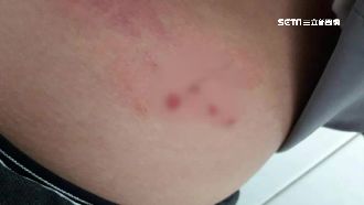 因沒繫皮帶　國三生遭師捏腰破皮流血