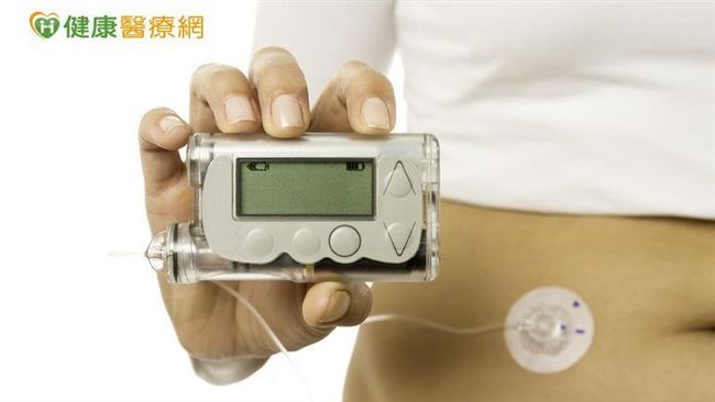 新型醫療！「人造胰臟」測試結果出爐