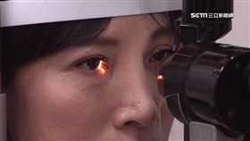 -眼睛-眼科-視力-乾眼症-