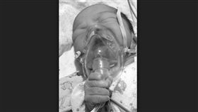 寶寶,氧氣罩 圖／翻攝自錢江晚報 16:9